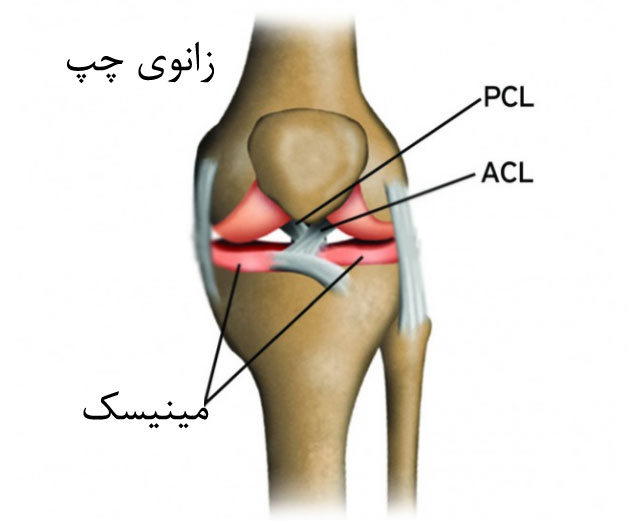 فیزیوتراپی رباط صلیبی شاهین شهر